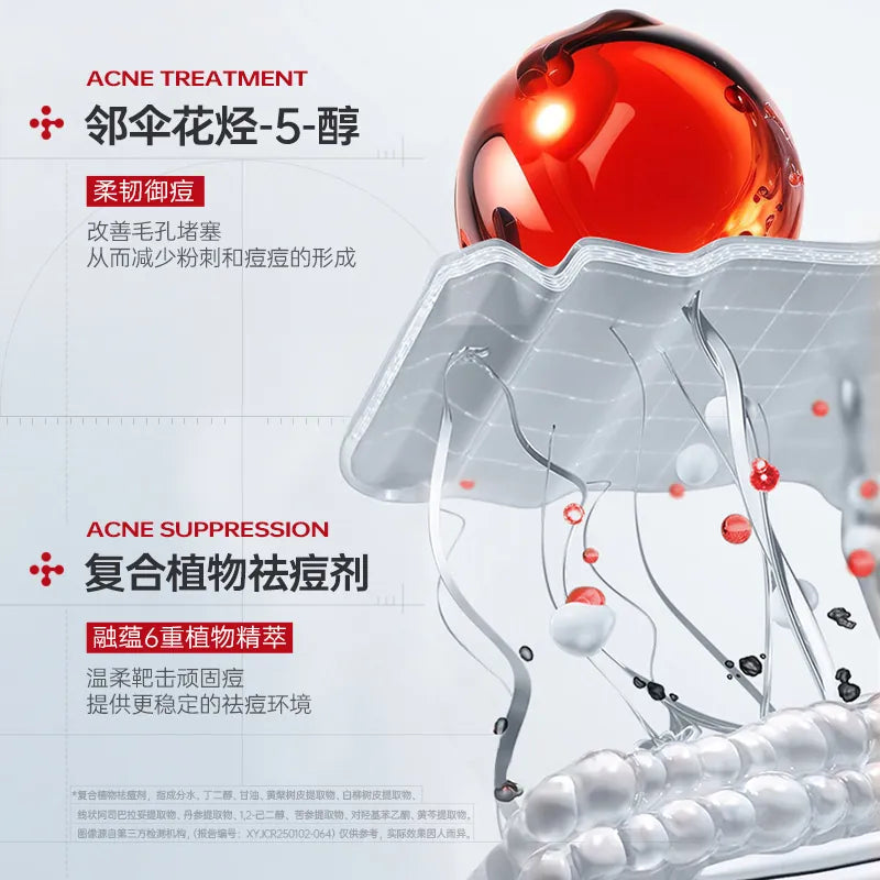 Agulia Salicylic Oil Control Anti-acne Cream